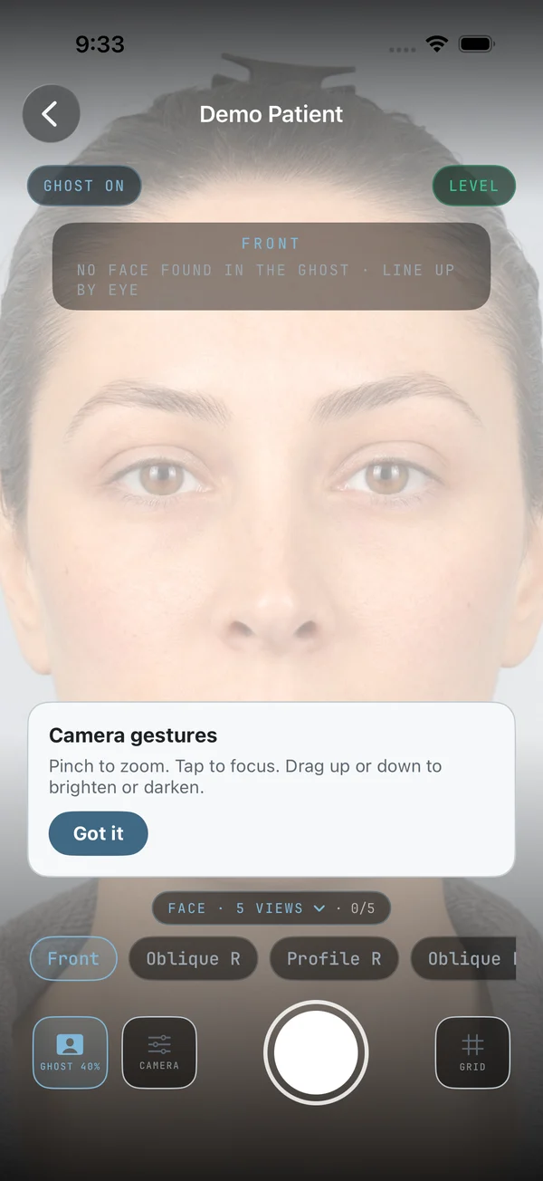 Capture screen with ghost overlay, level pill, series chips and shutter